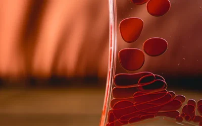 Sickle Cell Disorders – ICD 10 Codes and Documentation Tips