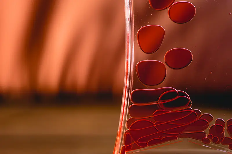 Sickle Cell Disorders - ICD 10 Codes and Documentation Tips