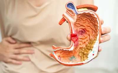 Abdominal Aortic Aneurysm Repair CPT Codes and Billing Guidelines