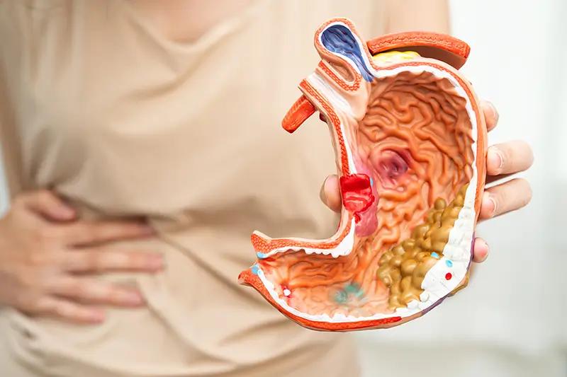 Abdominal Aortic Aneurysm Repair CPT Codes and Billing Guidelines