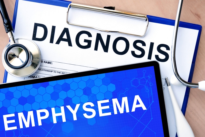 ICD-10 Codes for Coding Emphysema – A Chronic Obstructive Pulmonary Disease