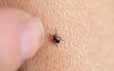 Lyme Disease – Its Clinical Documentation and Coding