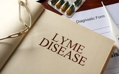 Lyme Disease – Its Clinical Documentation and Coding