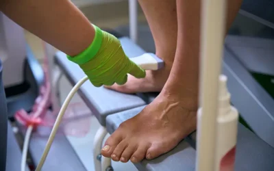 Peripheral Neuropathy – Causes, Symptoms, and Diagnosis Code Assignment