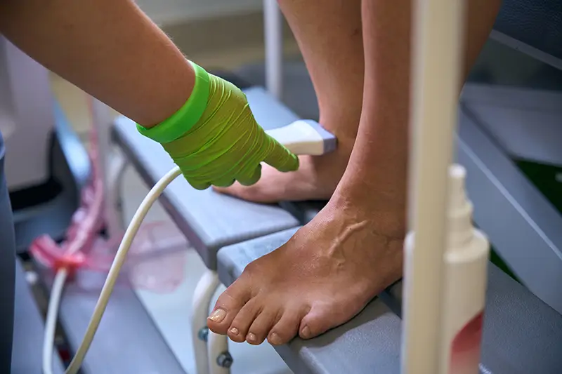 Peripheral Neuropathy - Causes, Symptoms, and Diagnosis Code Assignment