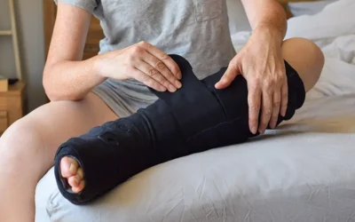 Key Considerations when Reporting Traumatic Fractures in ICD-10