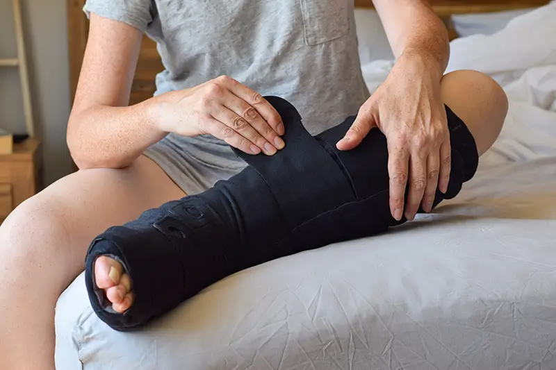 Key Considerations when Reporting Traumatic Fractures in ICD-10