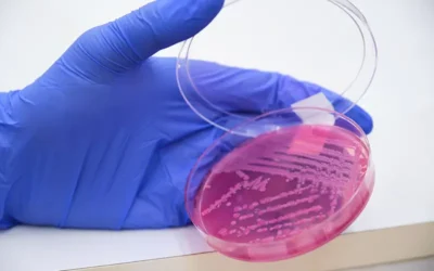 Coding Methicillin-resistant Staphylococcus Aureus (MRSA) Conditions