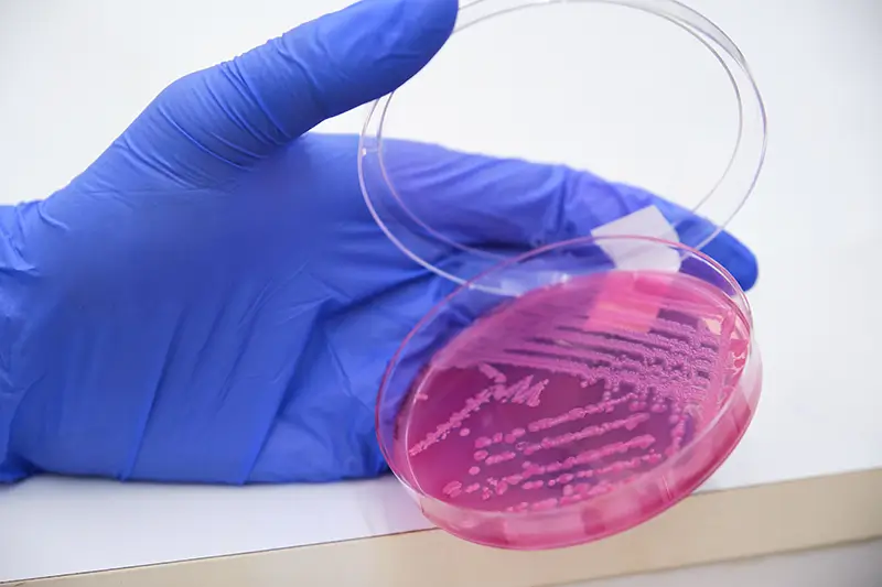 Coding Methicillin-resistant Staphylococcus Aureus Coding Methicillin-resistant Staphylococcus Aureus (MRSA) Conditions