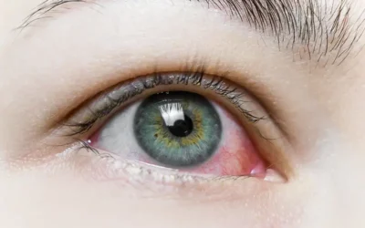 ICD-10 Codes for Reporting Uveitis