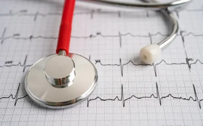 New ICD-10 Codes for Atrial Fibrillation in 2020