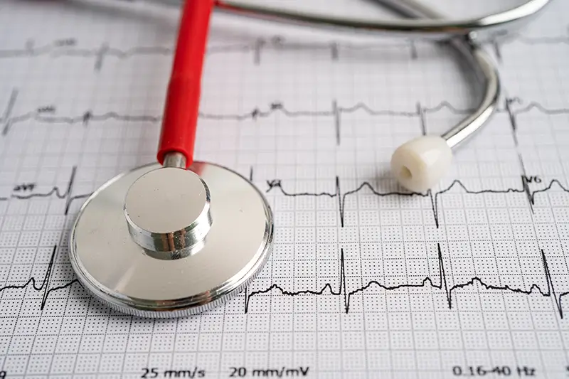 New ICD-10 Codes for Atrial Fibrillation in 2020