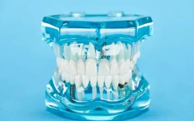 Why Does “D2950” Dental Core Buildup Code Face More Claim Denials?