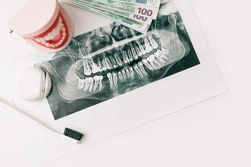 Understanding Dual Coverage in Dental Insurance