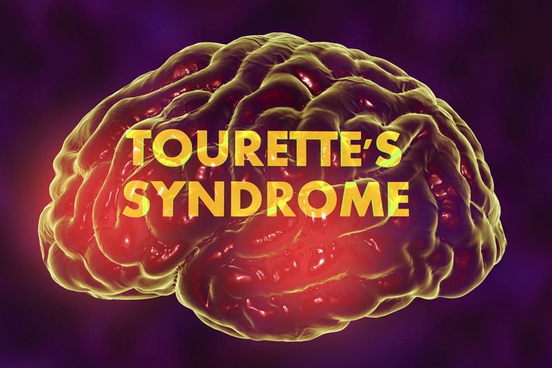 Documenting Tourette Syndrome (TS) – An Abnormal Neurological Disorder