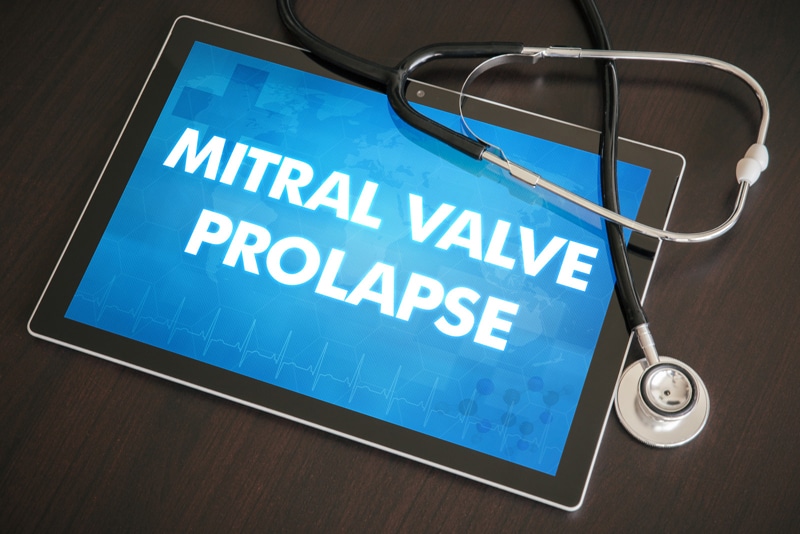 Coding Mitral Valve Prolapse