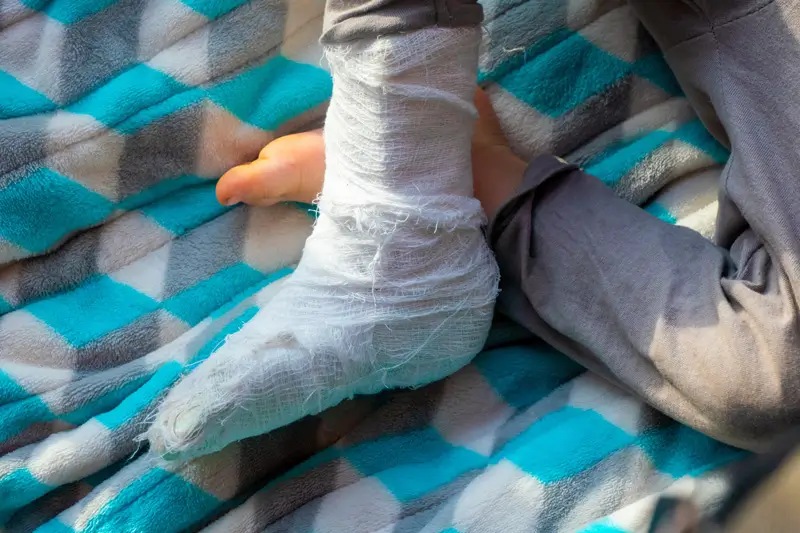 ICD-10 Codes for Halloween-related Injuries ICD-10 Codes for Halloween-related Injuries and Accidents