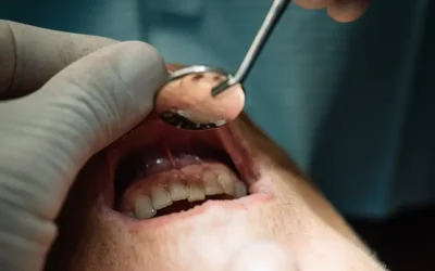 How to Code Gum Recession in Dental Billing