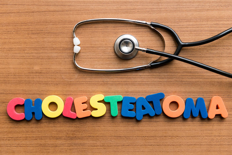 FAQ and ICD 10 Coding for Billing on Cholesteatoma