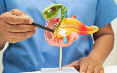 CPT Codes to Report Pancreatic Cancer Diagnosis and Treatment