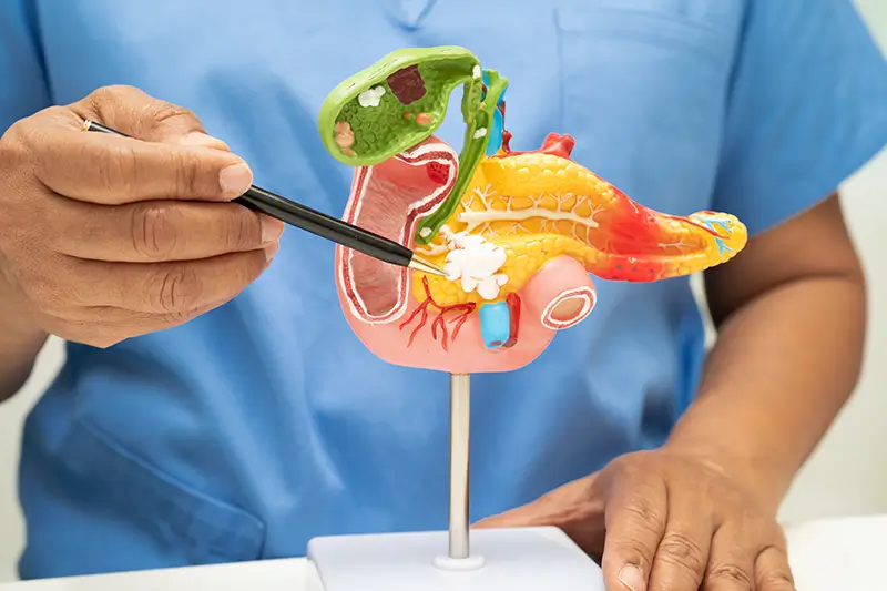 CPT Codes to Report Pancreatic Cancer Diagnosis and Treatment