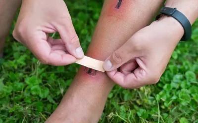 Documenting and Coding Different Types of Wounds – A Detailed Overview