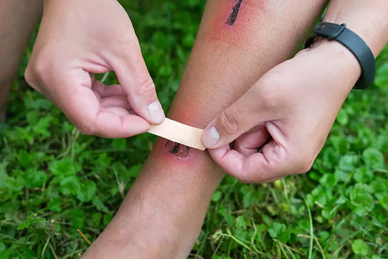Documenting and Coding Different Types of Wounds – A Detailed Overview