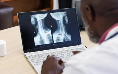 Coding Cervical Myelopathy – A Degenerative Disorder of the Cervical Spine