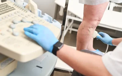 Deep Vein Thrombosis (DVT) – Diagnosis, Documentation and Coding