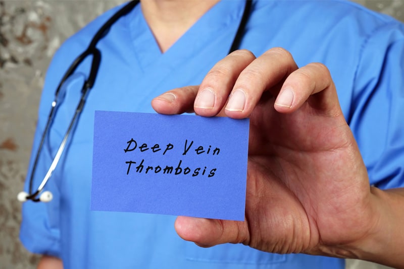 Deep Vein Thrombosis