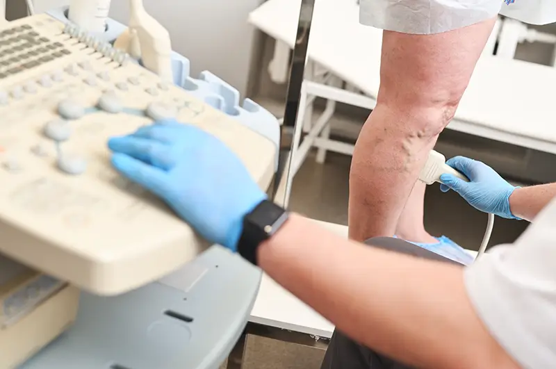 Deep Vein Thrombosis (DVT) – Diagnosis, Documentation and Coding