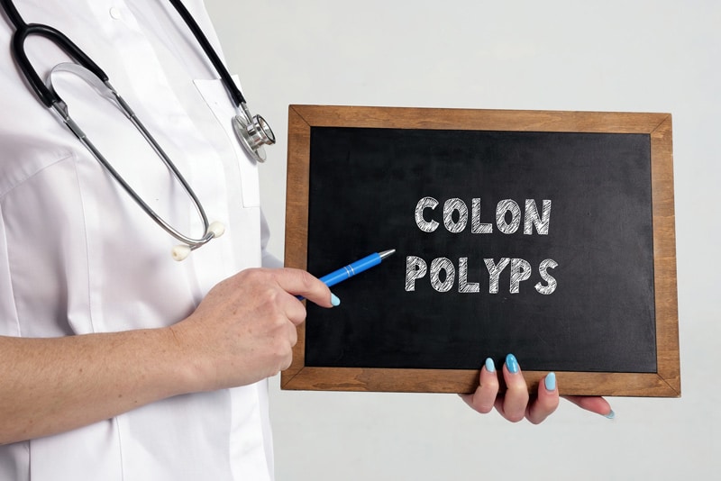 Colon Polyps – Diagnosis and ICD-10 Coding