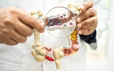 Colon Polyps – Diagnosis and ICD-10 Coding