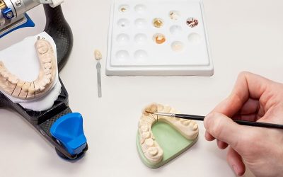What Are the CDT Codes to Report Dental Restoration Procedures?