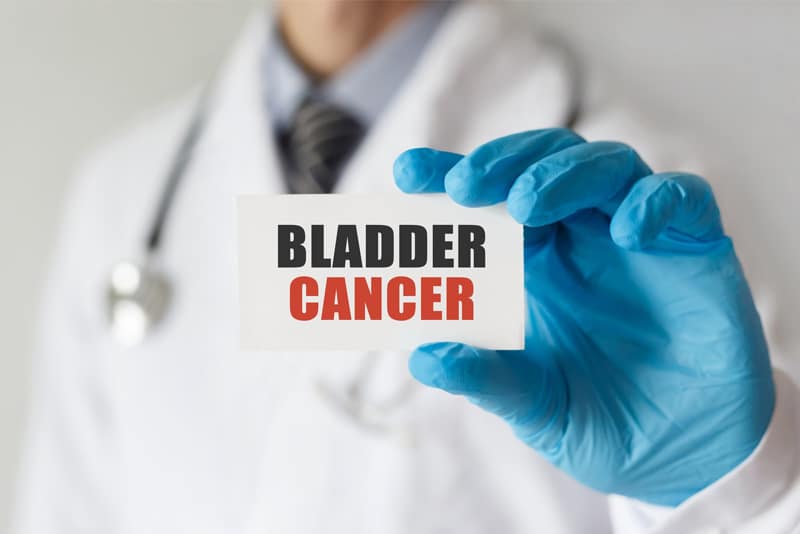 Bladder Cancer