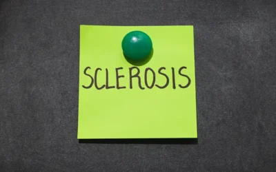 Reporting Systemic Sclerosis (SS) – A Connective Tissue Disorder