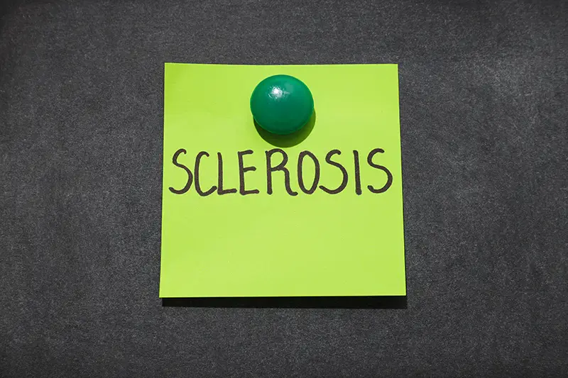 Reporting Systemic Sclerosis (SS) – A Connective Tissue Disorder