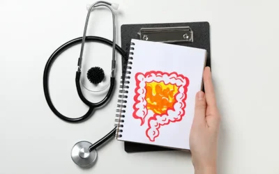 What Is Ulcerative Colitis? Know the Related ICD-10 Codes