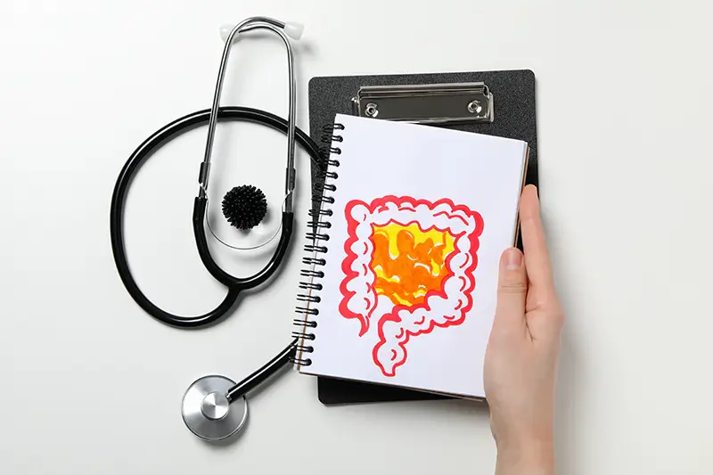 What Is Ulcerative Colitis? Know the Related ICD-10 Codes