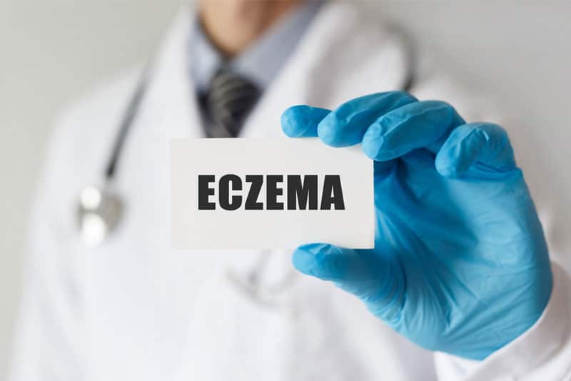 ICD-10 Codes To Report Eczema