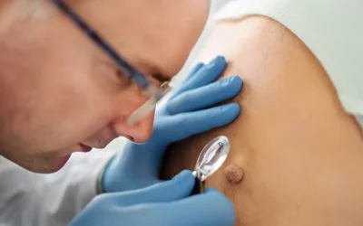 Billing Guidelines For Biopsy Services