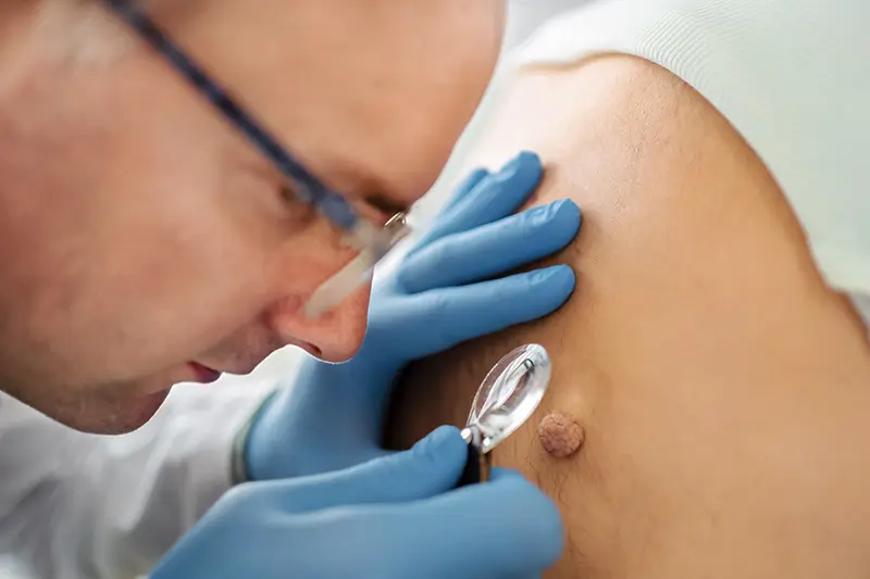 Billing Guidelines For Biopsy Services