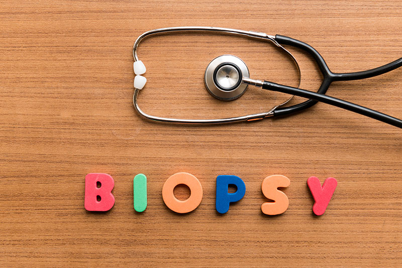 Billing Guidelines For Biopsy Services
