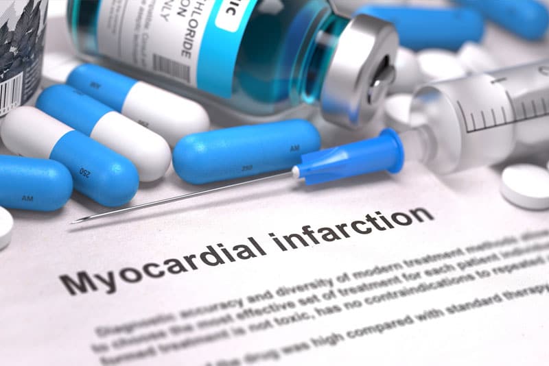 Myocardial Infarction