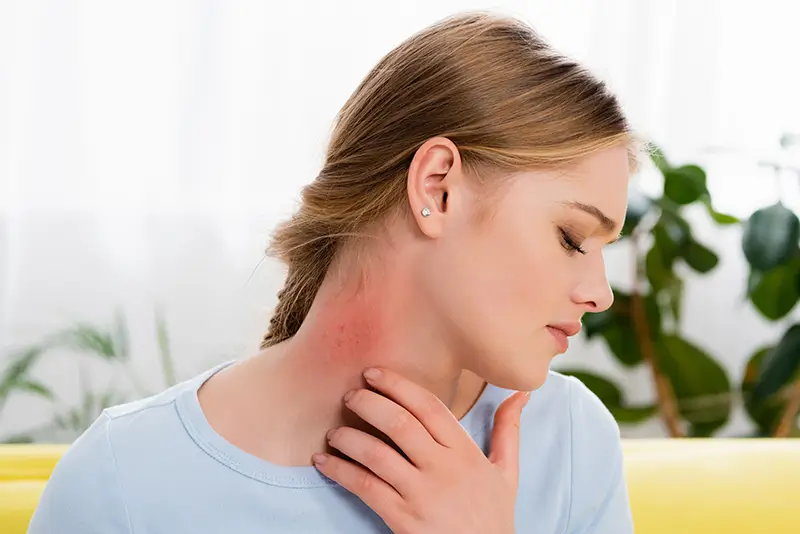 ICD-10 Codes For Common Inflammatory Disorders