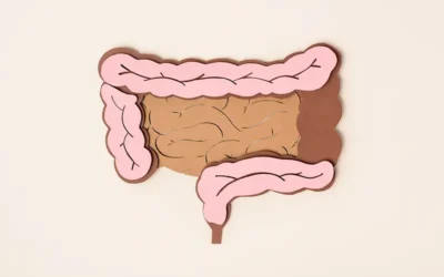 ICD-10 Codes To Report Diverticulosis