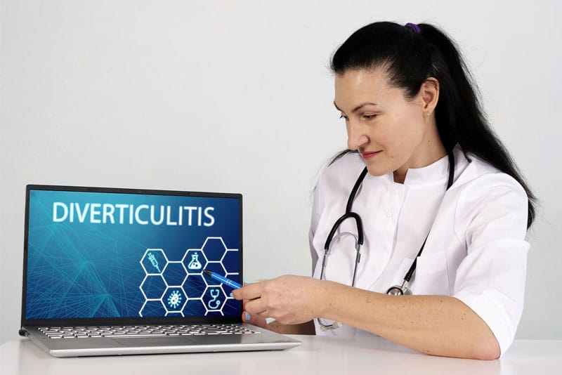 Diverticulosis