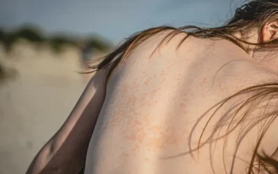 How To Document Celiac Disease – A Chronic Autoimmune Disorder