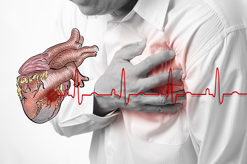 Cardiac Conditions