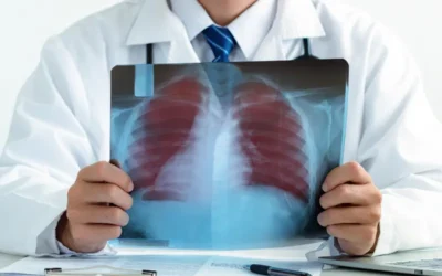 How Do You Code Chronic Lung Disease?